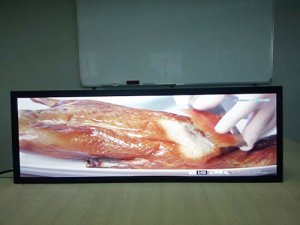 LCDl